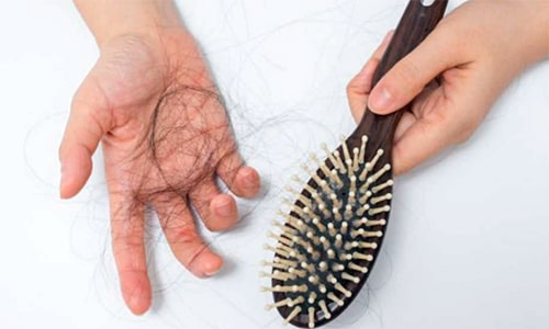 La caída brusca de cabello, otro de los efectos secundarios que deja la Covid 19
